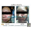 ครีมมุก PEARL WHITENING CREAM