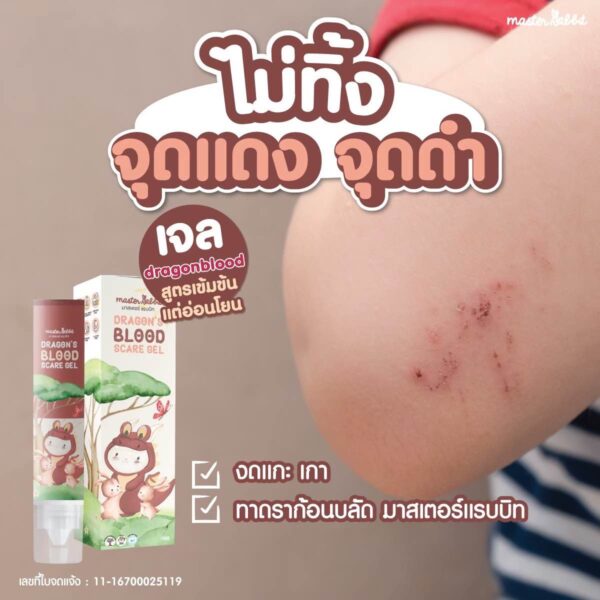 Master Rabbit Dragon’s Blood Scar Gel ดราก้อนบลัดสการ์เจล สำหรับเด็ก